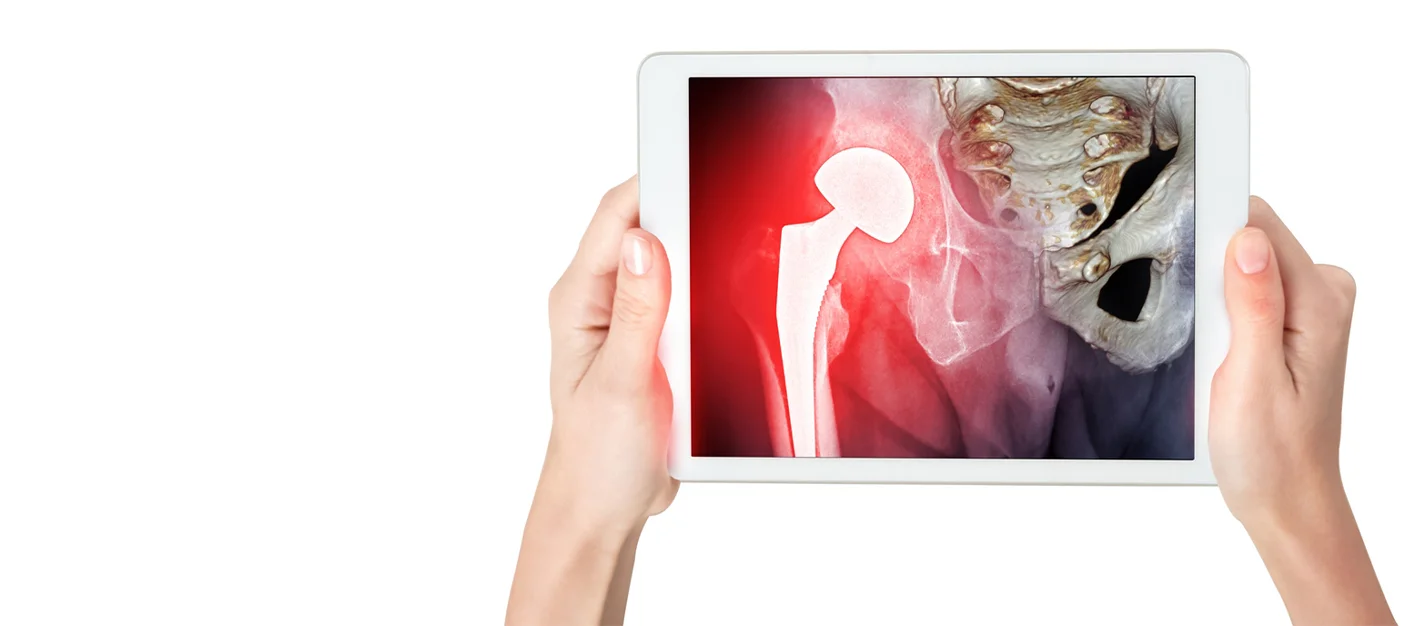Top Hip Replacement Surgery In Dwarka: Leading Experts & Advanced Care